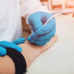 Электронейромиография: Загляни в нервы и мышцы! Полный гайд для любознательных