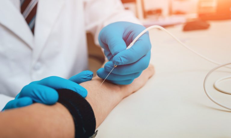 Электронейромиография: Загляни в нервы и мышцы! Полный гайд для любознательных